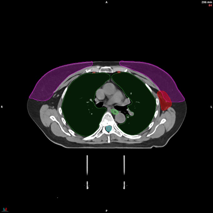 CT__SPINALCORD_66